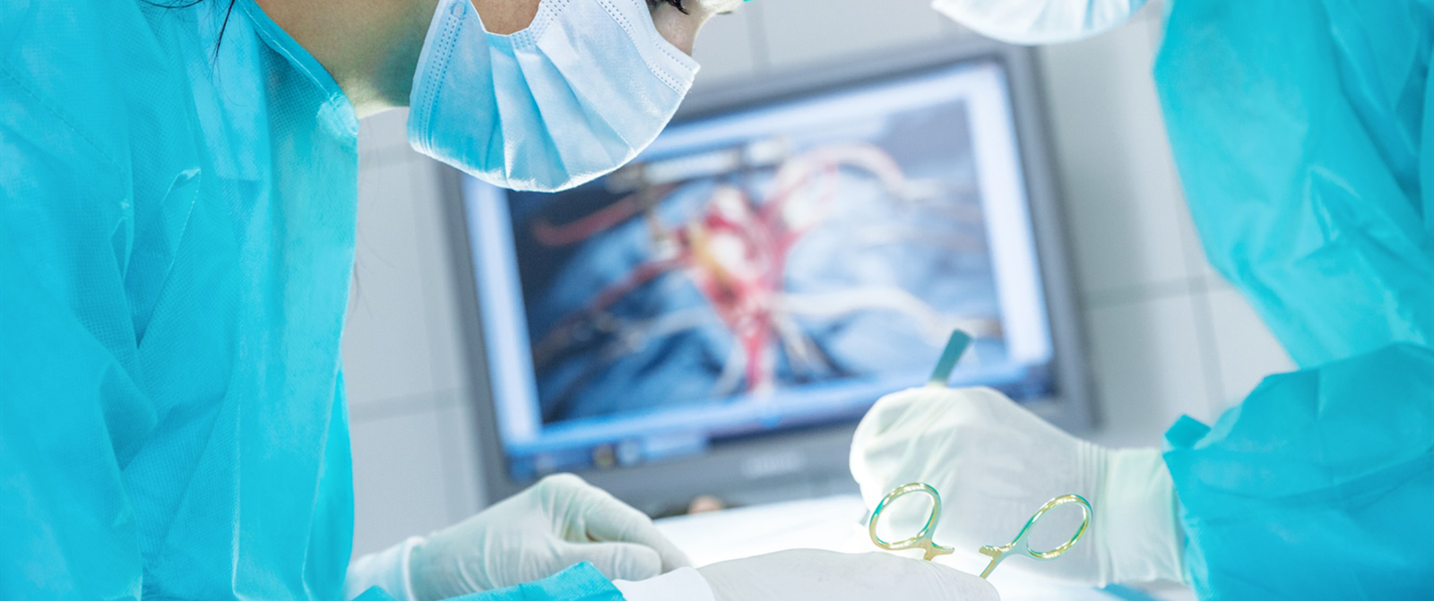 Cirurgia Vascular Cirurgia Vascular